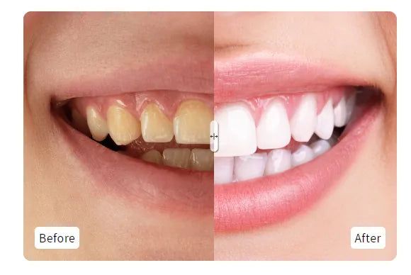 Before & After Slider