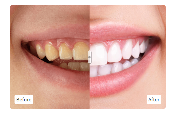 Before and After Image Slider preview